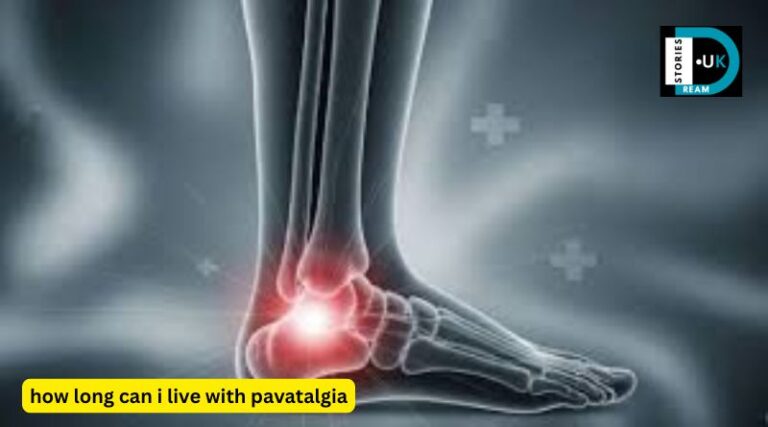 How Long Can I Live with Pavatalgia
